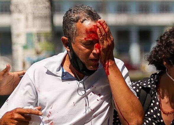 Agresión a Daniel Campelo, de 51 años, en su ojo izquierdo. Foto: Twitter @daniportalepsol