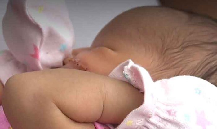 Un cirujano aplicó 13 puntos de sutura en la mejilla izquierda de la bebé que nació por una cesárea de emergencia. Foto: captura