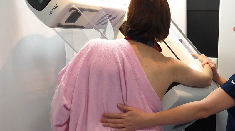 La tasa de pacientes que sobreviven tras el diagnóstico de cáncer de mama no ha cambiado significativamente en décadas, alertó un oncólogo durante un encuentro en México. Foto: Archivo/ EL COMERCIO