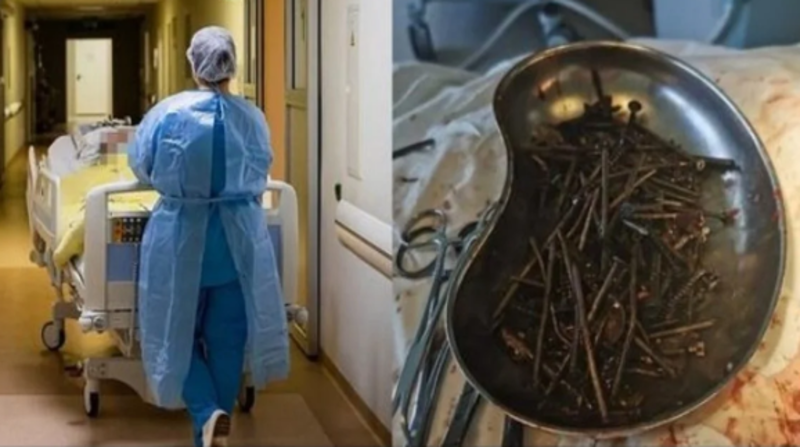 En la intervención, que duró aproximadamente tres horas, los cirujanos pudieron extraer cerca de un kilo de elementos metálicos. Foto: Captura / Redes Sociales
