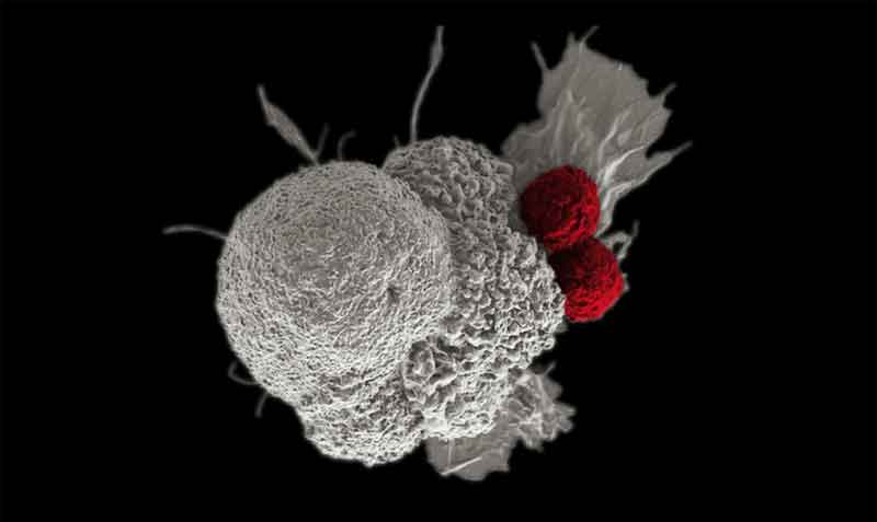 Imagen de una célula cancerosa escamosa oral (blanca) atacada por dos células T citotóxicas (rojo). Foto: NIH / ICR de Londres