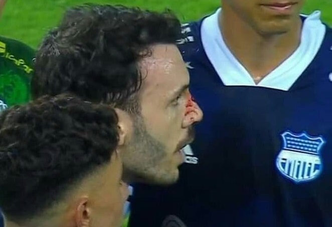 Sebastián Rodríguez sangrando durante el partido entre Emelec y Orense. Foto: Captura de pantalla