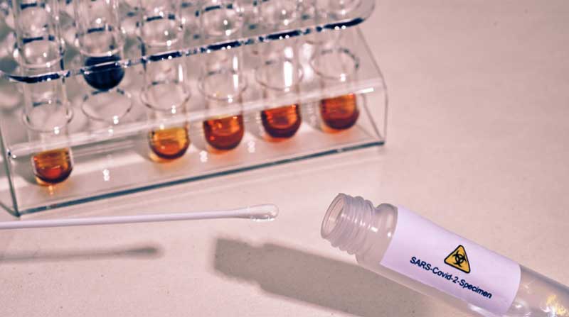 Imagen referencial. Madrid exige un certificado de vacunación o prueba PCR o de antígenos negativa realizada con un mínimo de 72 horas antes del arribo. Foto: Pixabay
