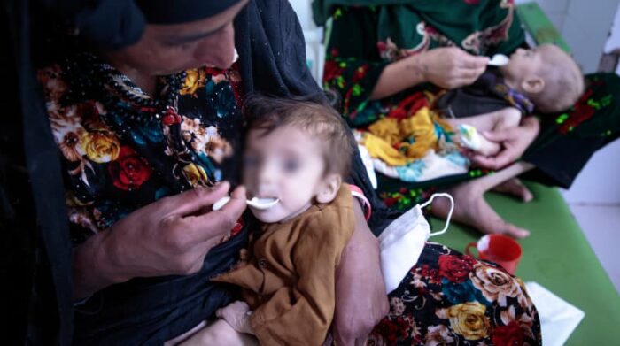 Afganistán, octubre 2021. Los niños desnutridos se alimentan en el Centro de alimentación terapéutica de MSF en el Hospital Regional de Herat. Foto: Sandra Calligaro 