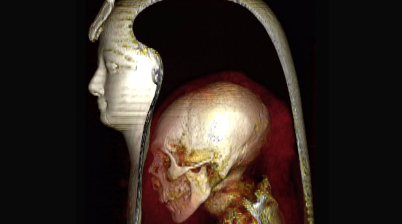 La imagen de TC tridimensional de la cabeza de la momia envuelta de Amenhotep I en una vista lateral izquierda permite la visualización de las capas componentes: la máscara, la cabeza de la momia y los vendajes circundantes. Foto: Frontiers in Medicine