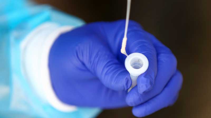 Personal médico toma una prueba PCR de detección de coronavirus. Foto: EFE