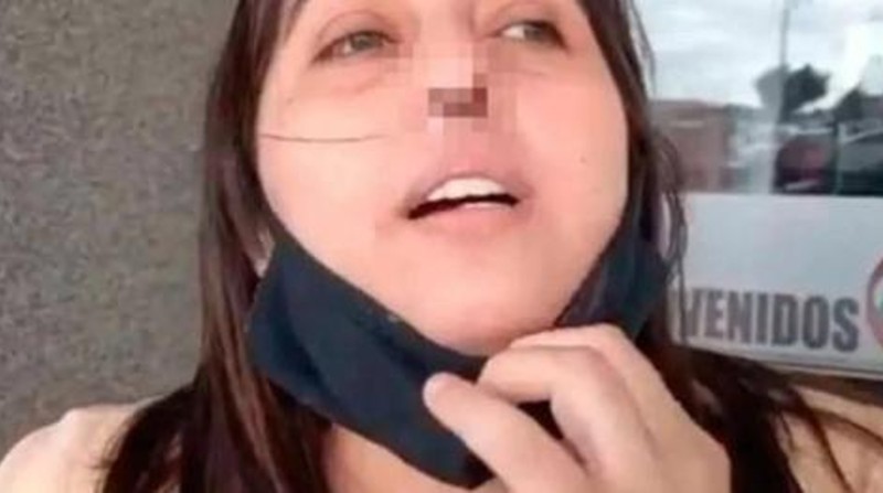 Claudia Serran afirma que perdió el cartílago de la nariz debido a una prueba PCR mal hecha en su natal Argentina. Foto: Facebook de Claudia Serran