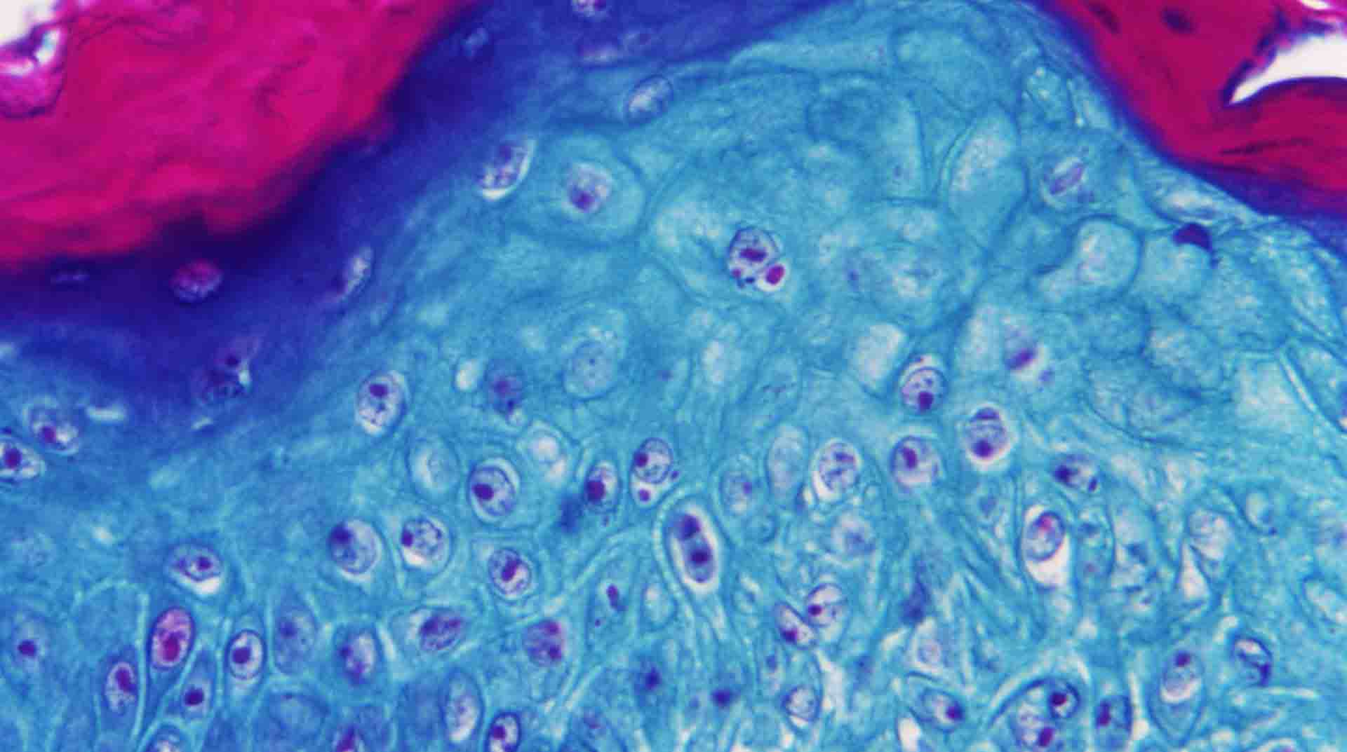 Imagen ampliada con un microscopio de una muestra de piel de un mono infectado con el virus de la viruela del mono. Foto: EFE.