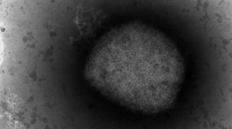 Imagen microscópica del virus causante de la viruela del mono, cuya secuenciación completa han logrado investigadores del Instituto de Salud Carlos III. Fotografía cedida por el Instituto de Salud Carlos III. Foto: EFE