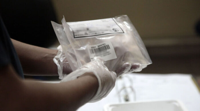 Imagen referencial. La OMS ha notificado 348 casos probables de hepatitis aguda grave. Foto: archivo / EL COMERCIO