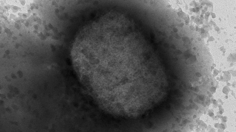 Imagen del virus de la viruela del mono por microscopía electrónica, facilitada por el Instituto de Salud Carlos III (Isc III) de Madrid, España. Foto: EFE