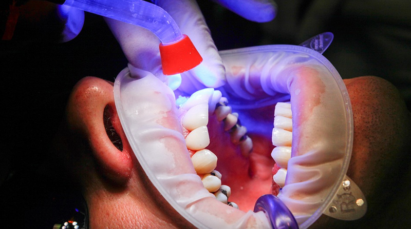 El cáncer oral puede presentarse de muchas formas. Foto: Pixabay