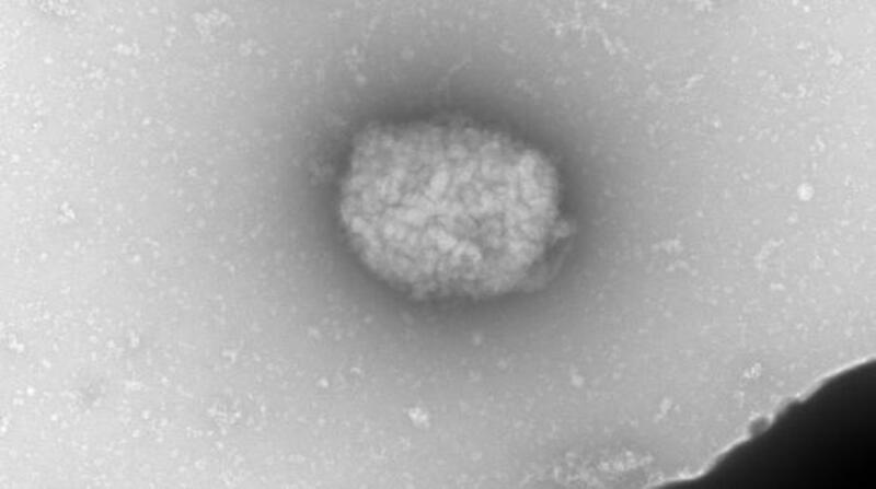 Partículas virales del virus del mono observadas por microscopia electrónica de transmisión directamente del líquido obtenido de pústulas de pacientes infectados. Foto: EFE