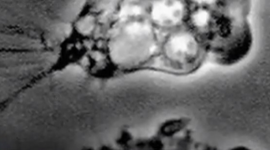 Imagen referencial. Un nadador se infectó con la ameba comecerebros en EE.UU. Foto: Caputra de pantalla.