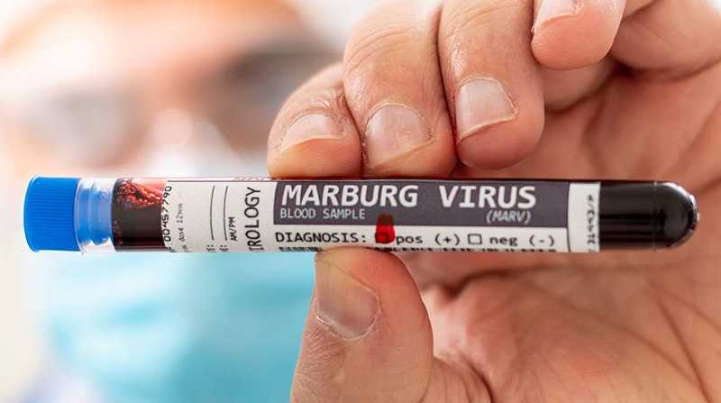 En Ghana se han detectado dos casos del brote de la enfermedad por el virus de Marburgo, similar a la del ébola. Foto: Internet