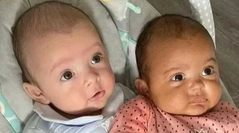 Dos gemelos tiene diferentes características físicas. Foto: Internet