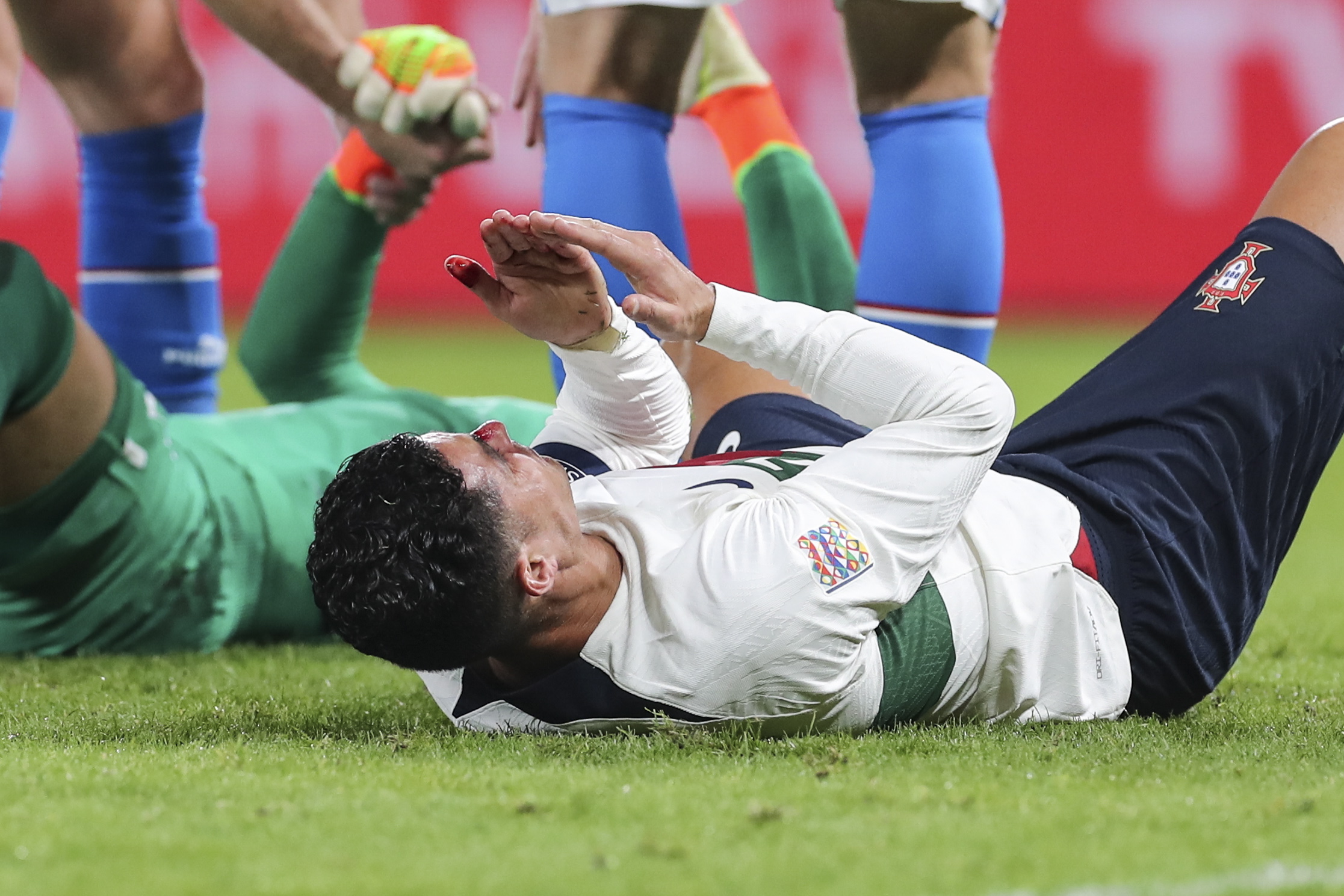 Cristiano Ronaldo con sangre, después del choque contra un rival. Foto: EFE