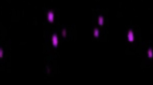 Imagen de cómo luce el virus del covid-19 cuando infecta las células. Foto: Captura de pantalla.