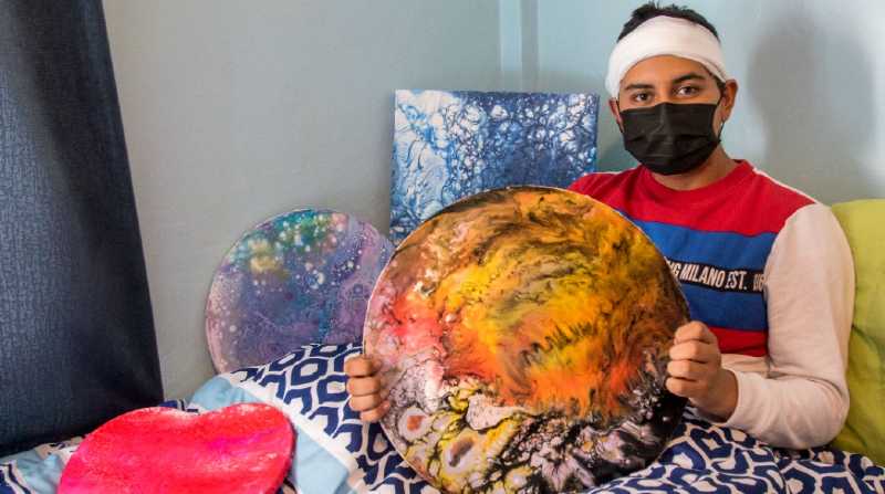 Xavier Ibarra, 15 años, realiza pinturas a manera de tratamiento después de haber recibido un impacto de bala de goma en la cabeza producto de un asalto. Foto: Carlos Noriega/ EL COMERCIO