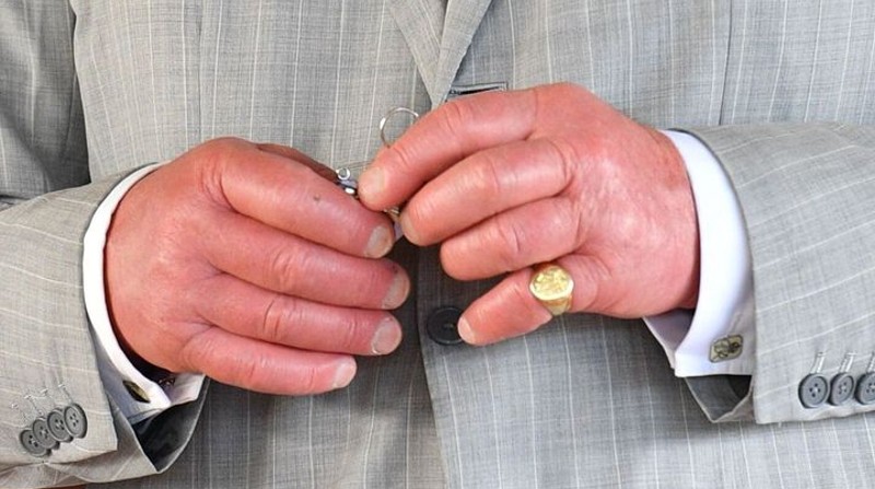 El aspecto de las manos del rey Carlos III han llamado la atención de las personas los últimos días. Foto: Twitter