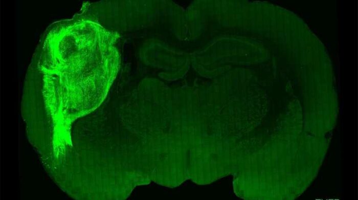 Un organoide humano trasplantado y marcado con una proteína fluorescente en una sección del cerebro de la rata. Foto: EFE/ Universidad de Stanford.
