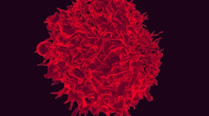 Micrografía electrónica de barrido coloreada de un linfocito T. Foto: NIAID