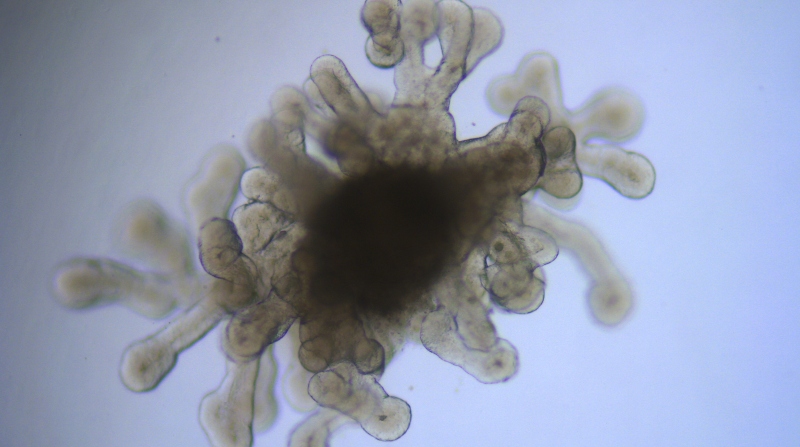 Micrografía de un minipulmón. Los organoides son versiones milimétricas de los órganos. Foto: Investigador Alberto Zambrano.