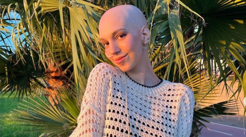 Elena Huelva Palomo le diagnosticaron sarcoma de Ewing a loas 16 años, el segundo tumor óseo más frecuente en la edad pediátrica. Foto: Instagram @elenahuelva02