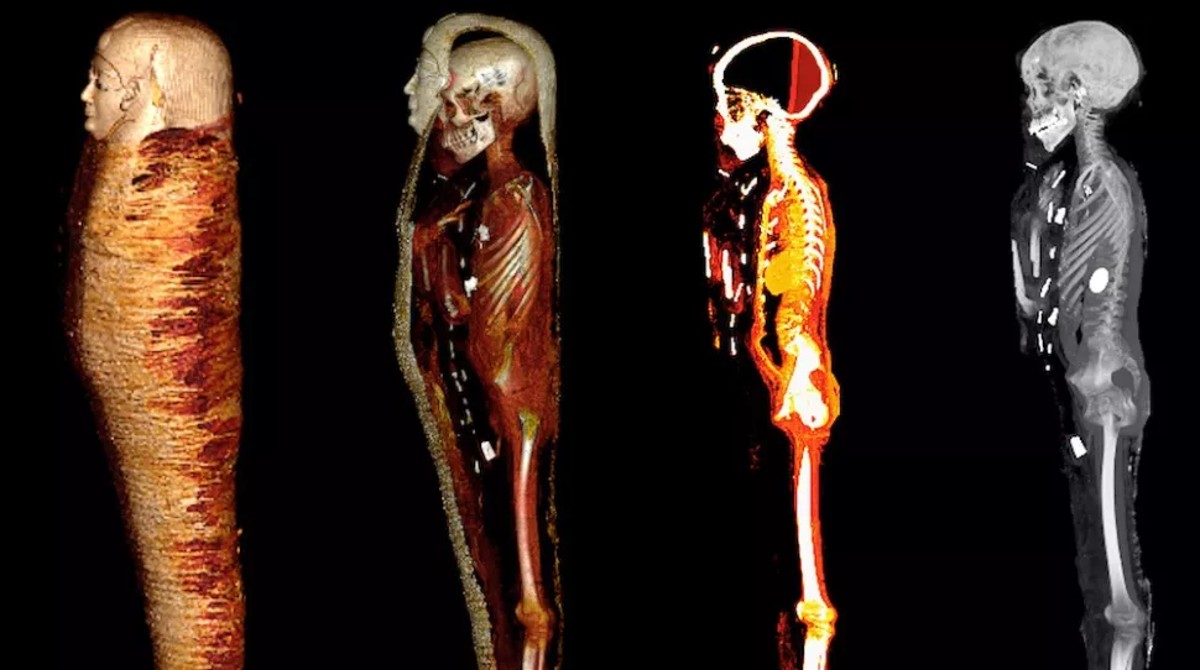 Los investigadores encontraron que los amuletos estaban colocados estratégicamente sobre o dentro del cuerpo de la momia. Foto: Museo Egipcio