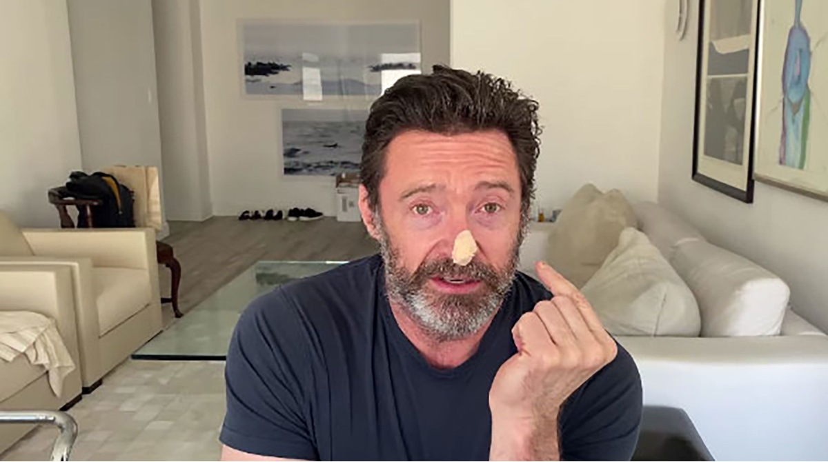 El actor Hugh Jackman difundió un video en el que aparece con un apósito en la nariz. Foto: Redes sociales del actor