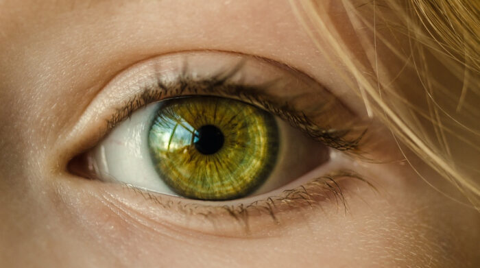El cáncer de ojo podría confundirse con una infección ocular leve. Foto: Pixabay