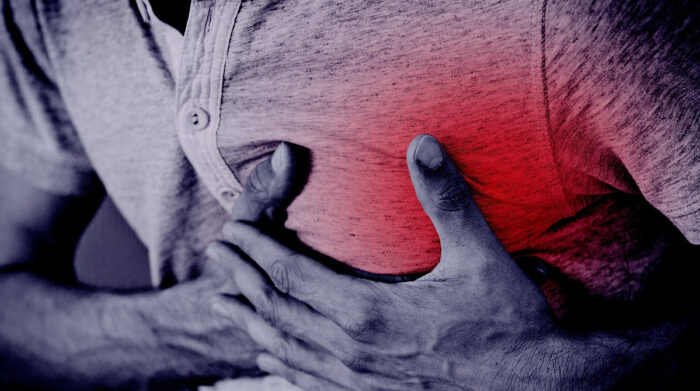 Dolor intenso en el pecho, síntoma de la insuficiencia cardíaca. Foto: Pixabay